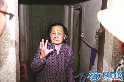 87岁的林阿婆脸上的伤痕和淤青还很明显